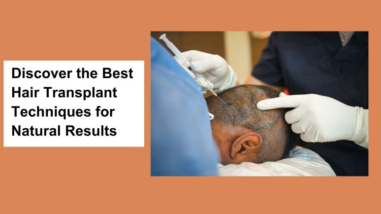Discover the Best Hair Transplant Techniques for Natural Results