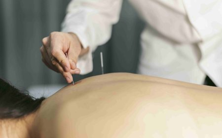 How Acupuncture Can Reduce Allergy Discomfort