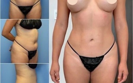 Is Body Contouring in Dubai Right for You? Factors to Consider