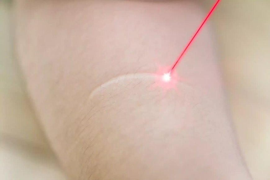 Restore Balance and Confidence with Hormone Therapy and Laser Scar Treatment in Lakewood Ranch, FL