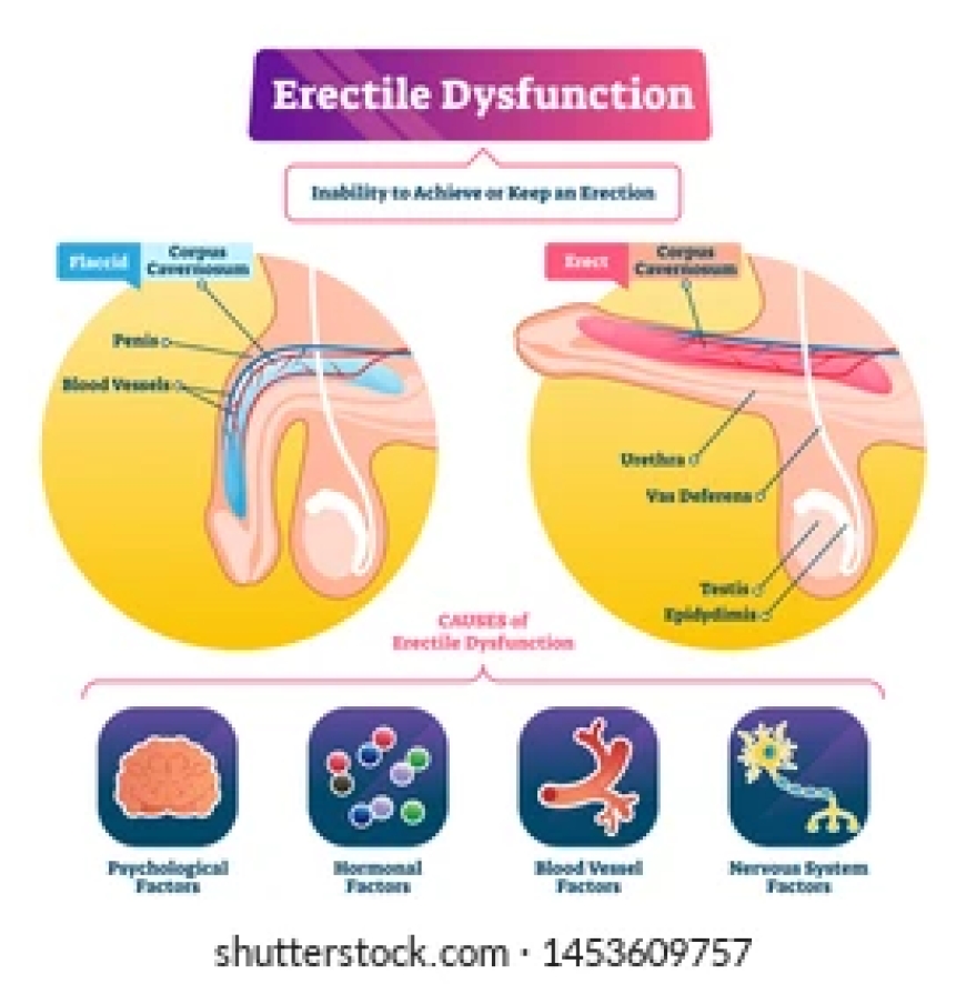 Kamagra Jelly: Exploring Its Place in the Sildenafil Landscape