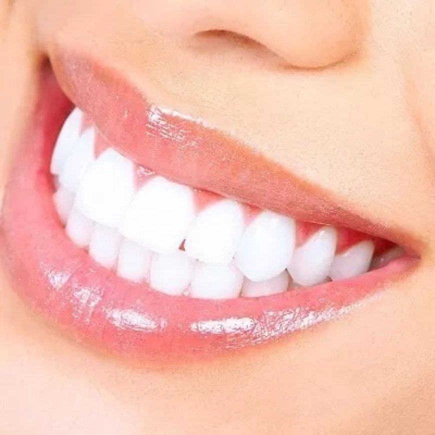Is Laser Teeth Whitening Worth the Price?