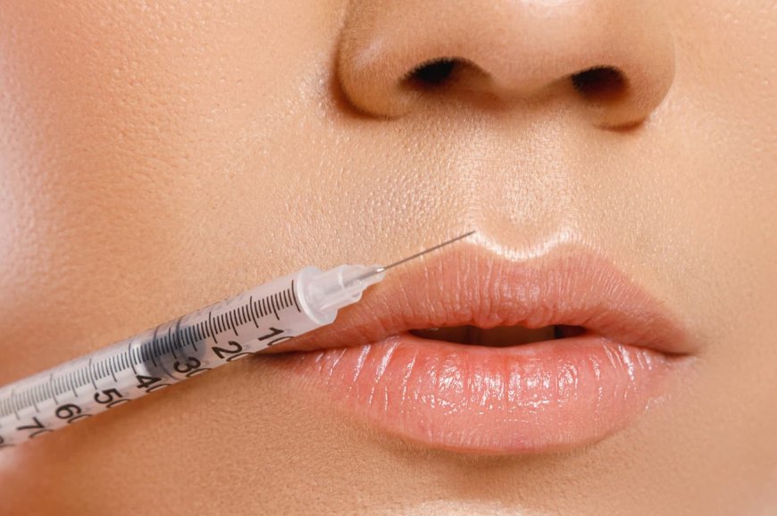 Smooth Fine Lines Around Lips with Best Lip Fillers Injections