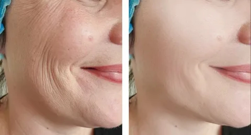 Gesichtsfalten und Ernährung: Diese Lebensmittel helfen wirklich