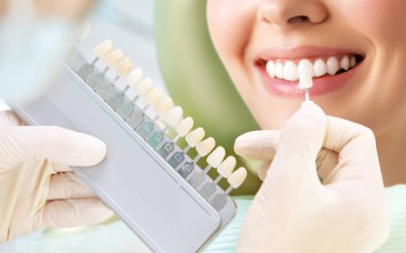 Whitening for Darker Enamel: How Riyadh’s Dentists Personalize Protocols by Ethnicity