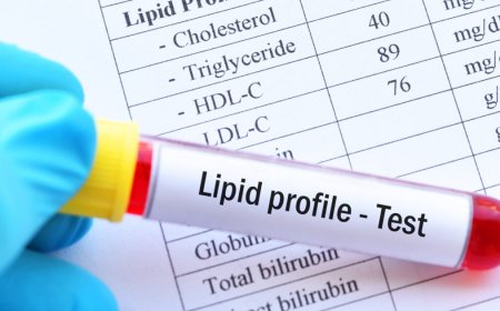 Lipid Profile Test: Understanding Cholesterol, Triglycerides, and Heart Health