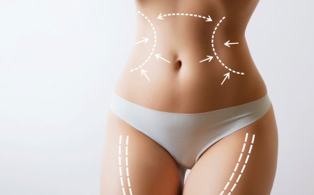 Vaser 4D Liposuction for a Smooth Shape Without the Hard Work