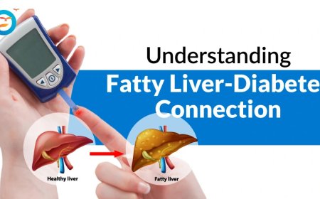 Pancreatitis and Diabetes: How They’re Connected