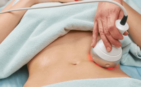 Why Liposonix Is Gaining Popularity Among Men and Women