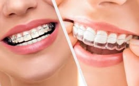 Orthodontic Treatment in Hoodi: A Comprehensive Guide to Straighter Smiles