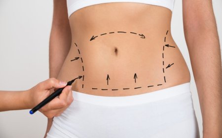 Informed Choices Matter Guidance from Best Liposuction Surgeons in Dubai