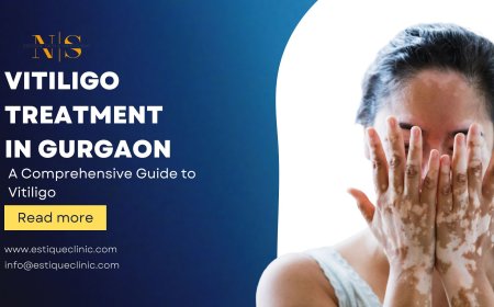 A Comprehensive Guide to Vitiligo