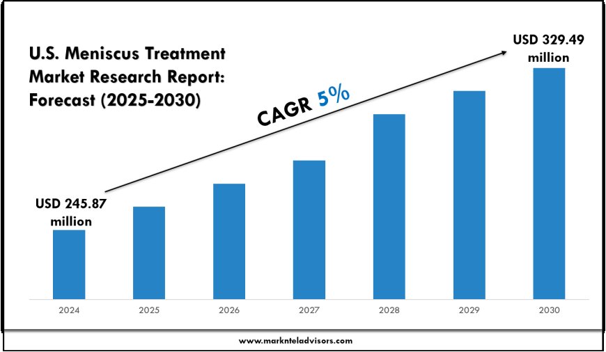U.S. Meniscus Treatment Market Forecast by Segment and Geography