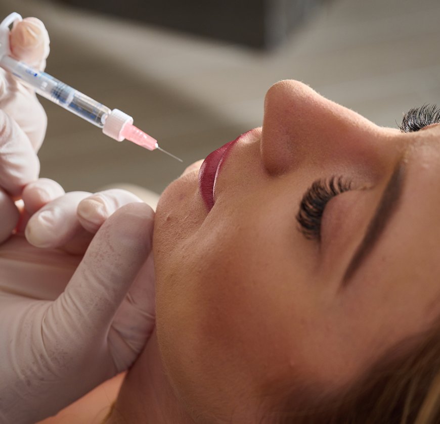 Best Lip Fillers Injections to Instantly Boost Lip Volume Safely