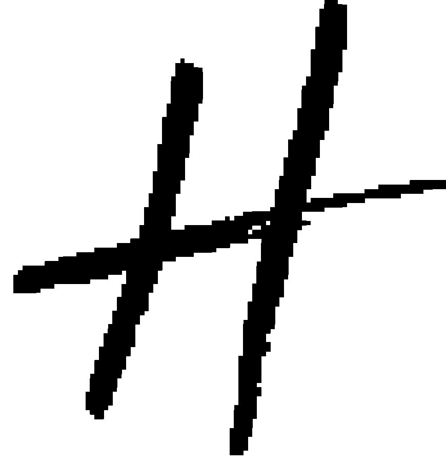 Ocd treatment in delhi  Best Psychiatrist in South Delhi